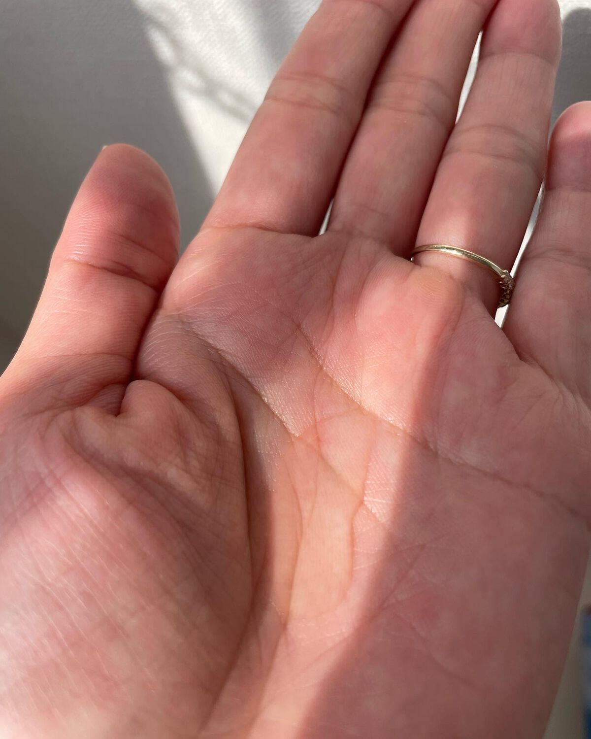 ケシミン浸透化粧水 しっとりタイプ/ケシミン/化粧水を使ったクチコミ（2枚目）