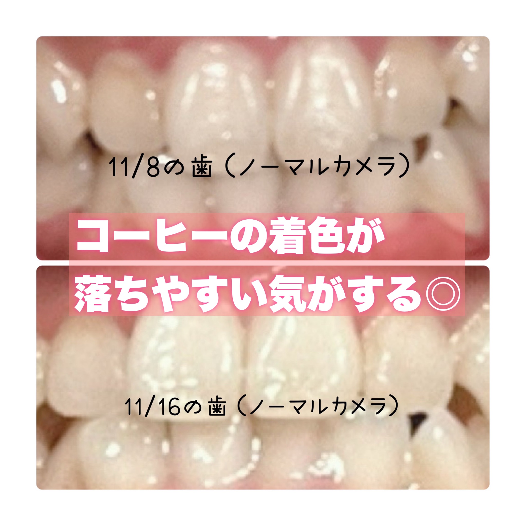 ブレステック/ホワイトエッセンス/歯磨き粉を使ったクチコミ（2枚目）