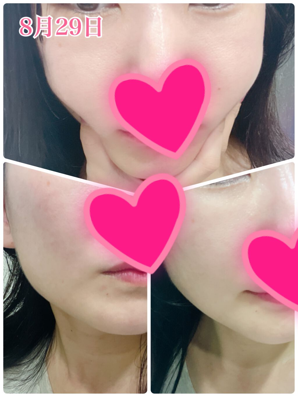 Rin Lift massage pack SF/Rin/その他スキンケアを使ったクチコミ（3枚目）