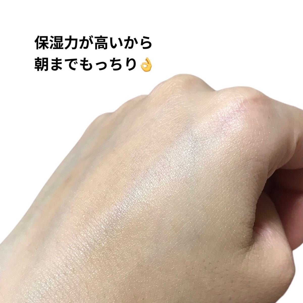 アトバリア365クリーム/AESTURA/フェイスクリームを使ったクチコミ(6枚目)