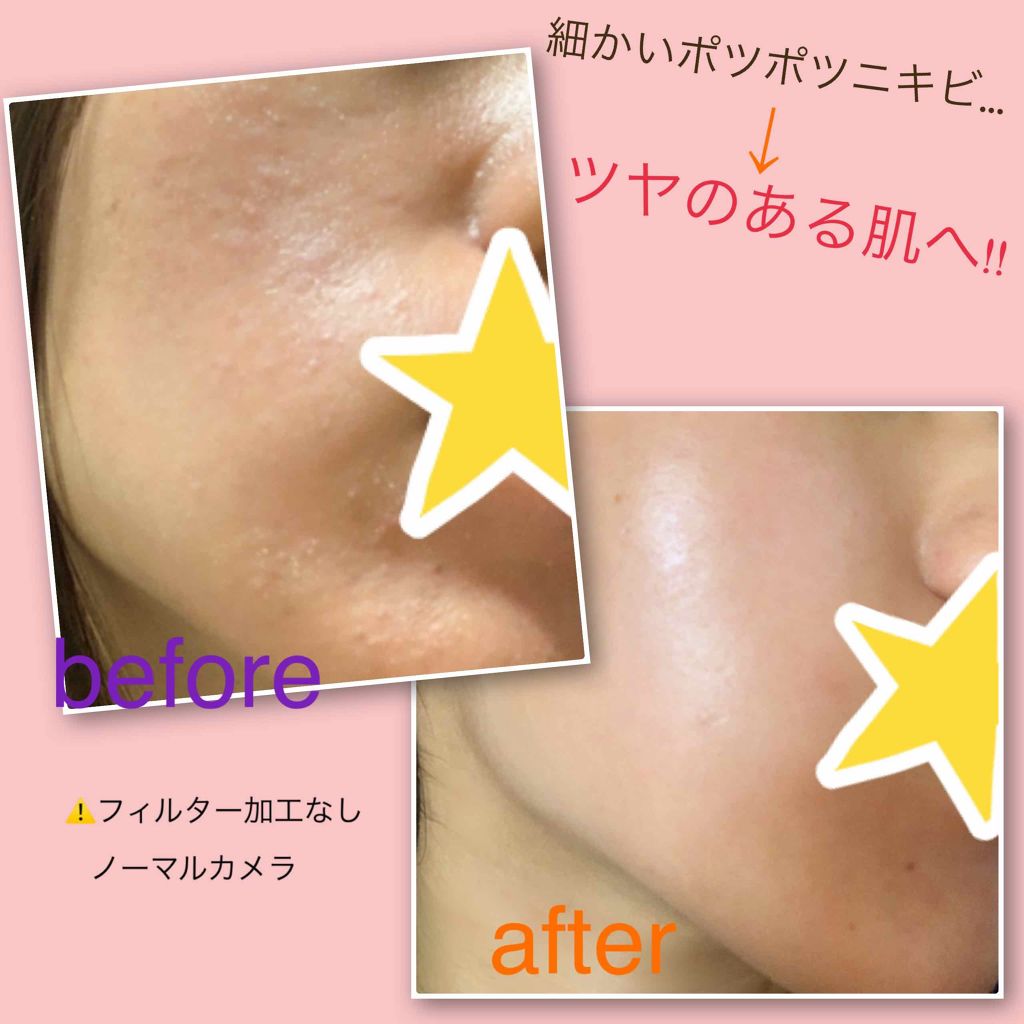 ハトムギ保湿ジェル(ナチュリエ スキンコンディショニングジェル)/ナチュリエ/美容液を使ったクチコミ(2枚目)