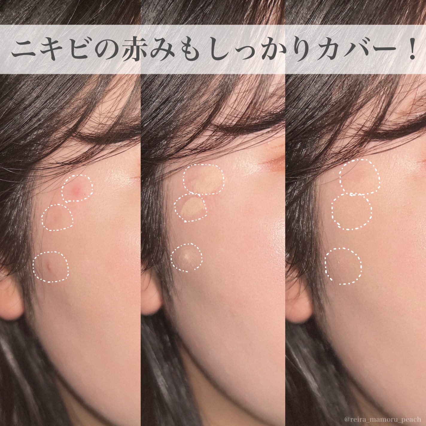 カバーアッププロコンシーラー/TFIT/パレットコンシーラーを使ったクチコミ(5枚目)