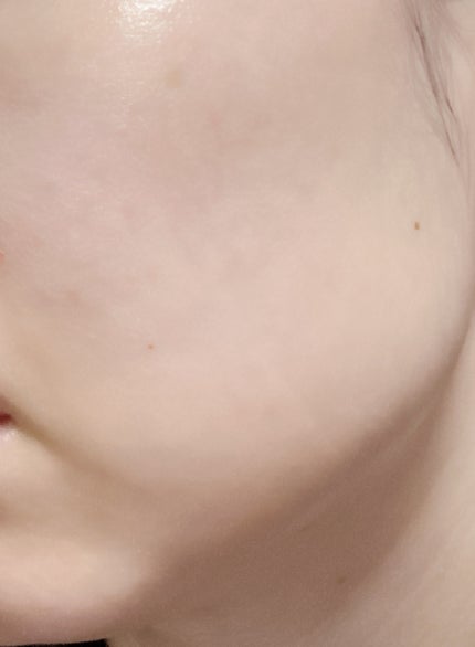 オイデルミン エッセンスローション/SHISEIDO/化粧水を使ったクチコミ(3枚目)