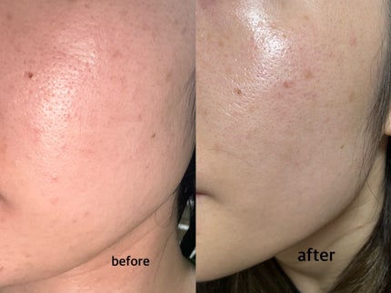 アビブ グルタチオンソームダークスポットセラムビタドロップ/Abib /美容液を使ったクチコミ(5枚目)