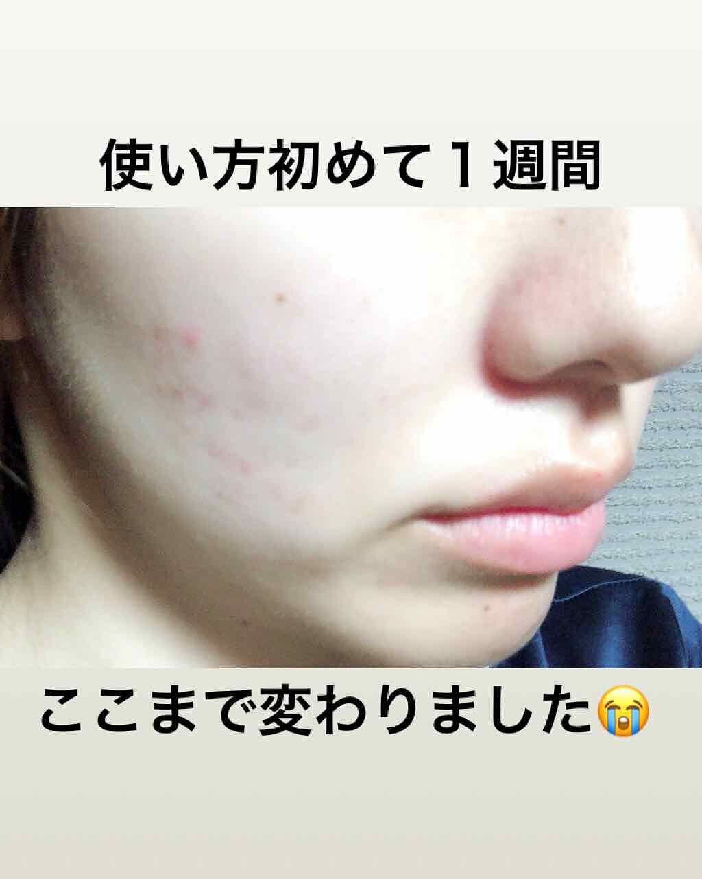 ワンステップオリジナルクリアパッド/COSRX/トナーパッドを使ったクチコミ（3枚目）