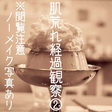 経過観察その二。
3日に1回くらいでいこうと思います。

痒い場合って、たとえばダニとかが原因かも？
ダニがいなくなるスプレー購入しました。

#肌荒れ経過観察