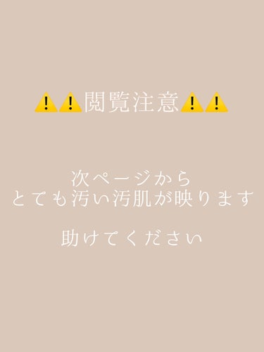 乳液・敏感肌用・さっぱりタイプ/無印良品/乳液を使ったクチコミ（1枚目）