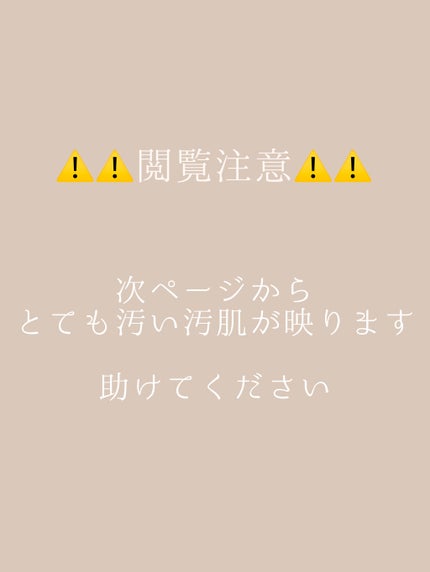 ハトムギ化粧水(ナチュリエ スキンコンディショナー R )/ナチュリエ/化粧水を使ったクチコミ(1枚目)