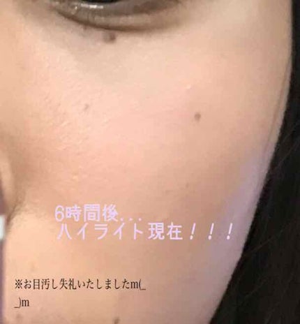 イーブン ベター スポッツ コンセントレート コンシーラー 21 03 ホワイト/CLINIQUE/スティックコンシーラーの画像