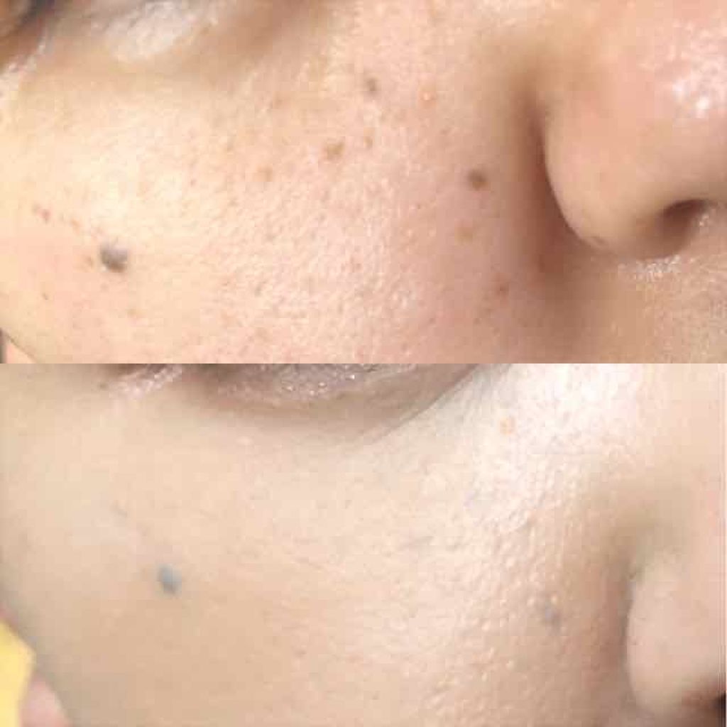 パウダリースキンメイカー/KATE/リキッドファンデーションを使ったクチコミ（1枚目）