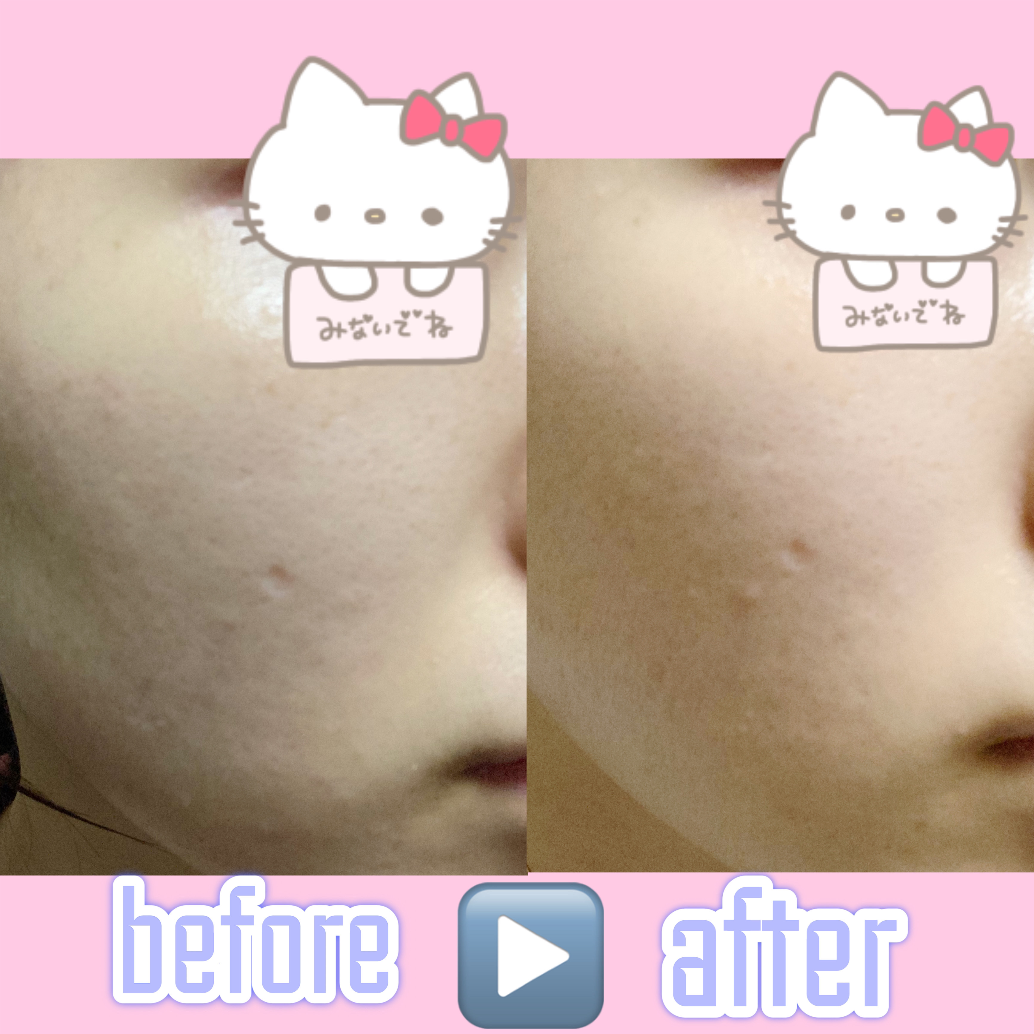 レチノール スーパーバウンス セラム/IOPE/美容液を使ったクチコミ（2枚目）