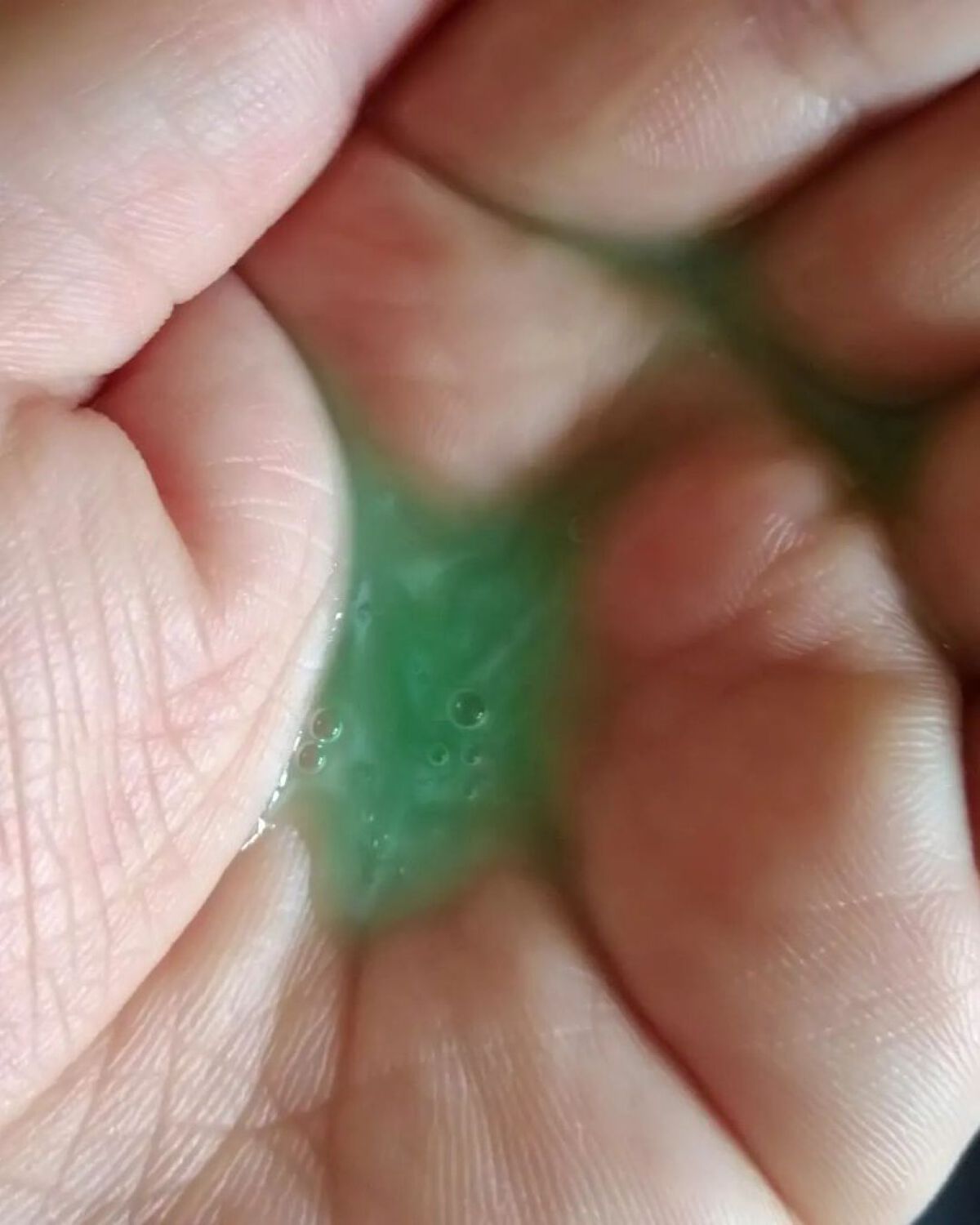 フェイス＆ボディウォッシュ/セバメド/ボディソープを使ったクチコミ（2枚目）