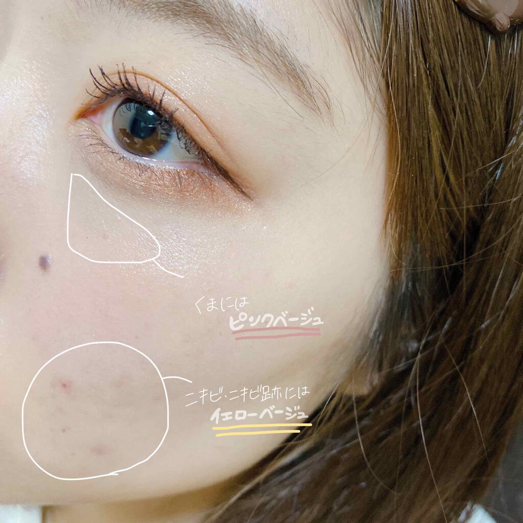 マジックコンシーラー/カリプソ/リキッドコンシーラーを使ったクチコミ(1枚目)