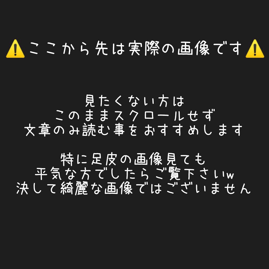 ましゅまろ素足/ピコモンテ/レッグ・フットケアを使ったクチコミ(3枚目)