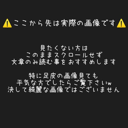 ましゅまろ素足/ピコモンテ/レッグ・フットケアを使ったクチコミ(3枚目)