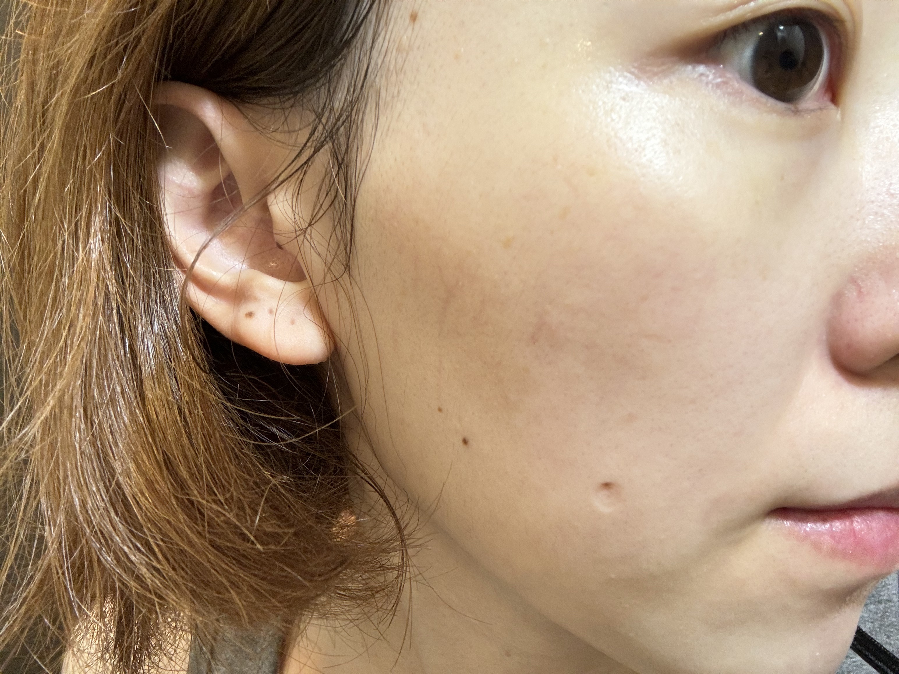 ざくろ ファーミングローション EX/WELEDA/化粧水を使ったクチコミ（3枚目）