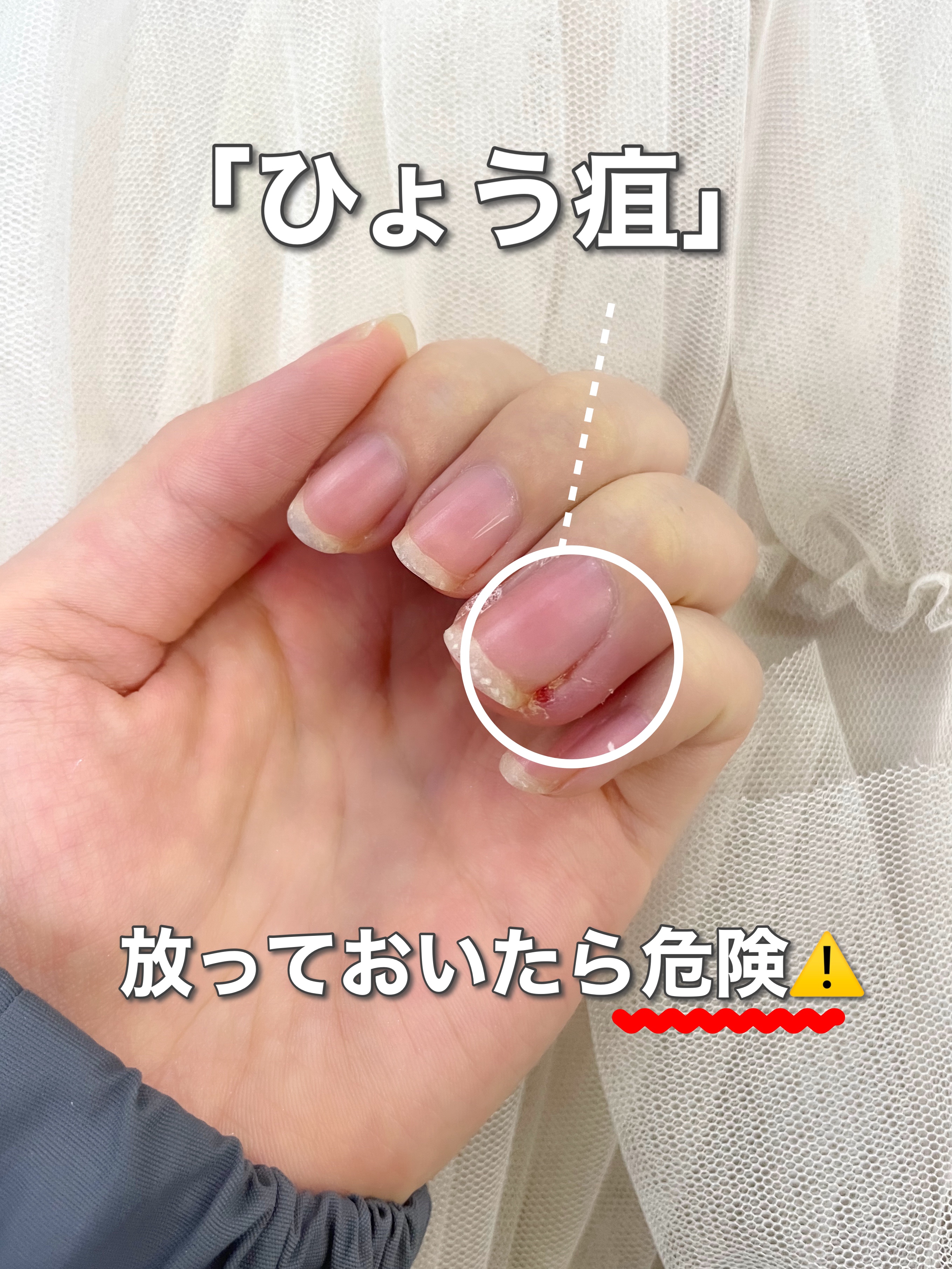 ビューティーチャージ 無香料/アトリックス/ハンドクリームを使ったクチコミ（1枚目）