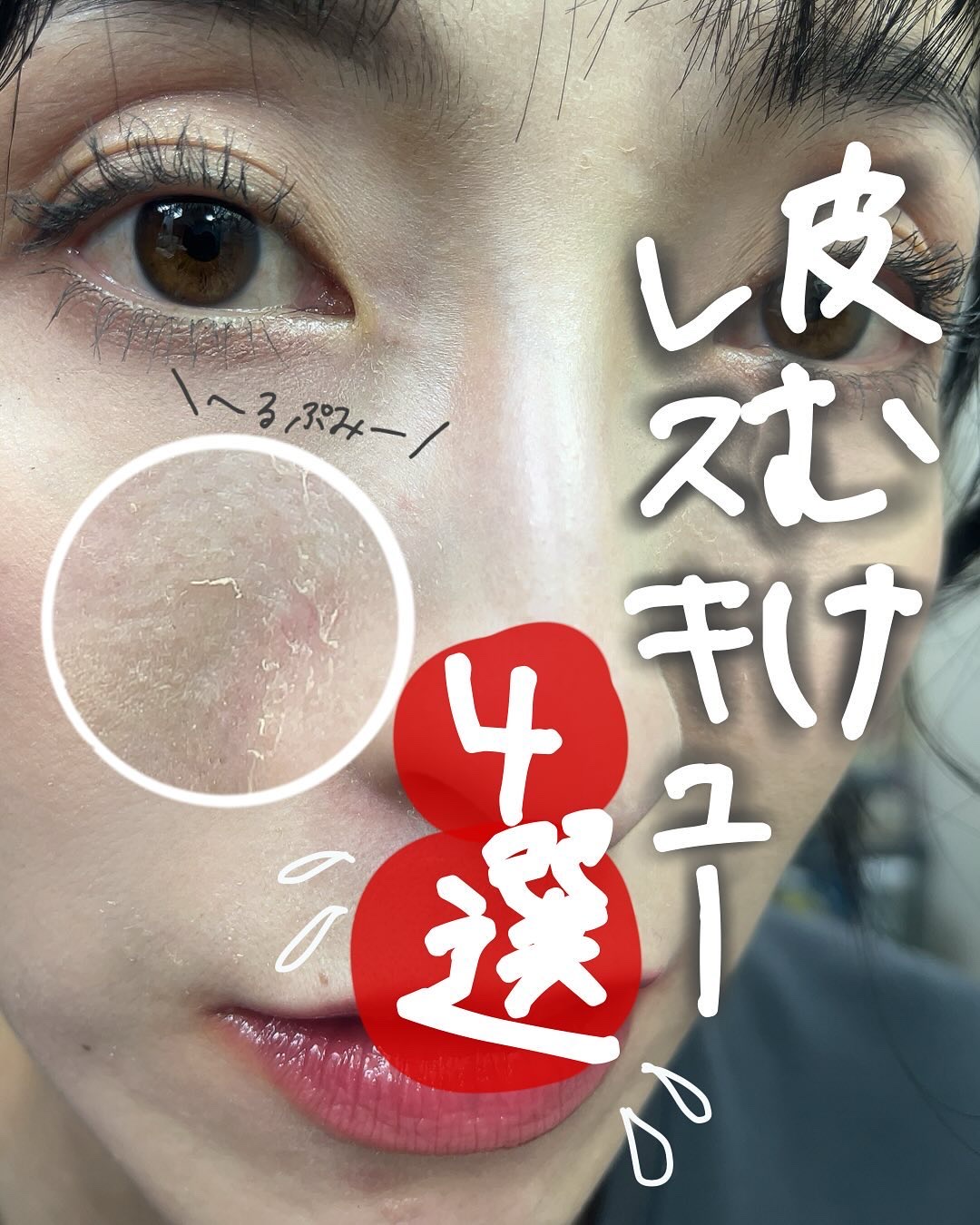 メディプラスゲル/メディプラス/オールインワン化粧品を使ったクチコミ（1枚目）