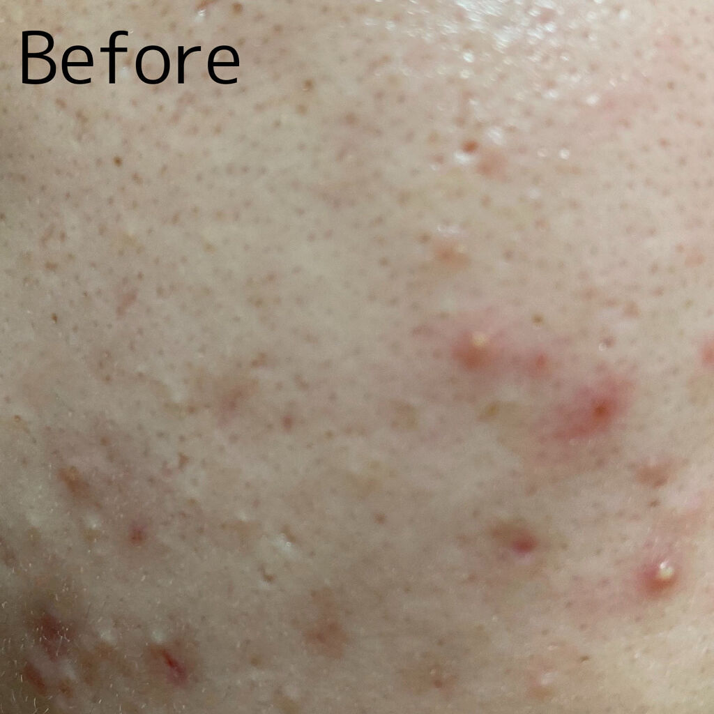 菊正宗 日本酒の化粧水 透明保湿/菊正宗/化粧水を使ったクチコミ（2枚目）