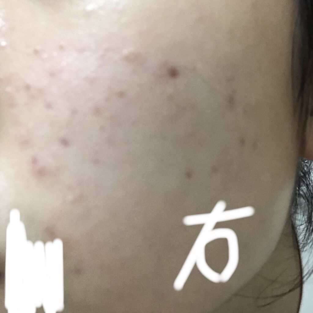 スキンケアセット（とてもしっとり）/IHADA/トライアルキットを使ったクチコミ（1枚目）