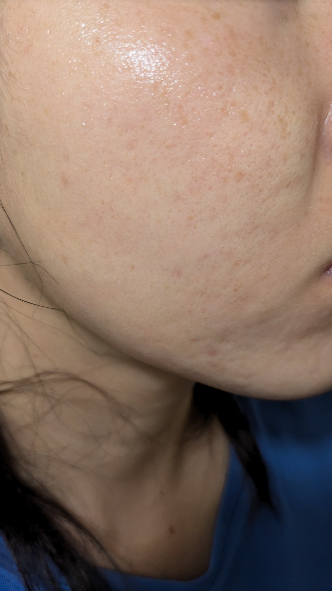 薬用リンクルナイトクリーム ホワイト/なめらか本舗/フェイスクリームを使ったクチコミ（1枚目）