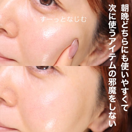 Cリンクエッセンス/ビューティフルスキン/美容液を使ったクチコミ(5枚目)