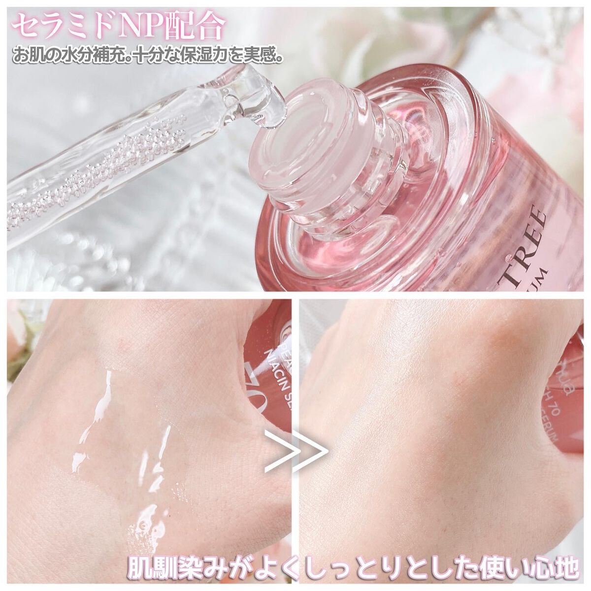 ピンクティーツリートナー/APLIN/化粧水を使ったクチコミ(5枚目)