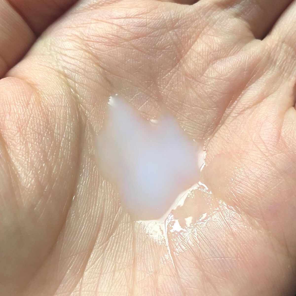 CERAPYome Moist In Treatment/my skin solus/美容液を使ったクチコミ(4枚目)