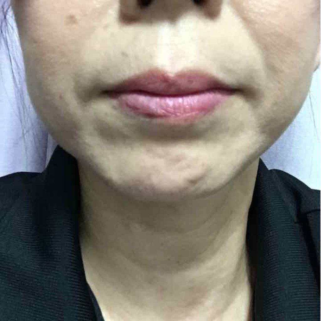 オペラリップティント/OPERA/口紅を使ったクチコミ(3枚目)