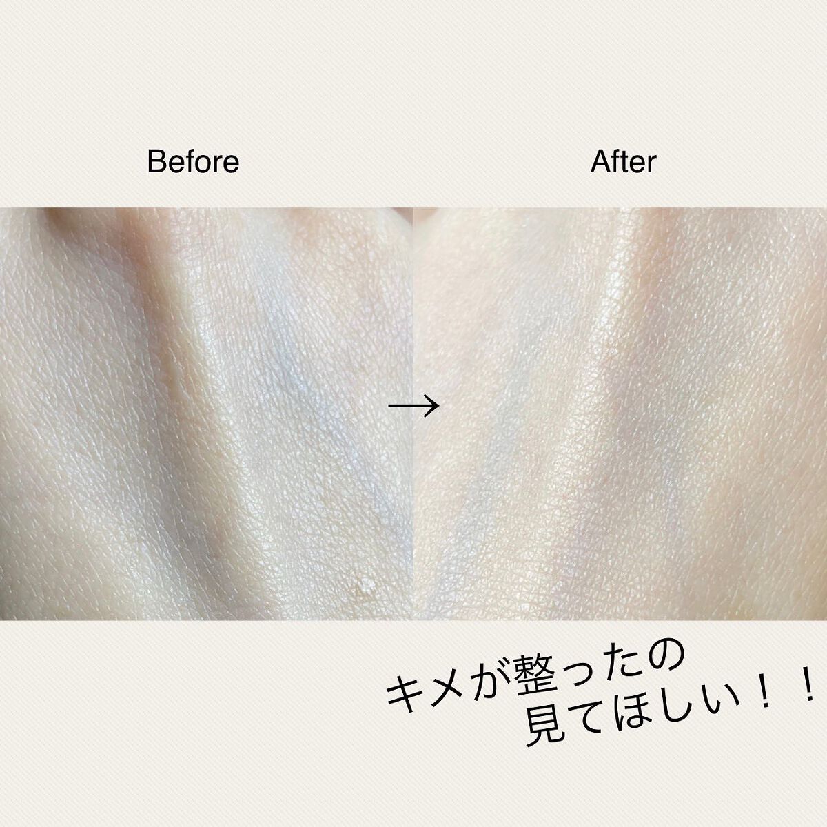 RXザ・ビタミンC23セラム/COSRX/美容液を使ったクチコミ(5枚目)