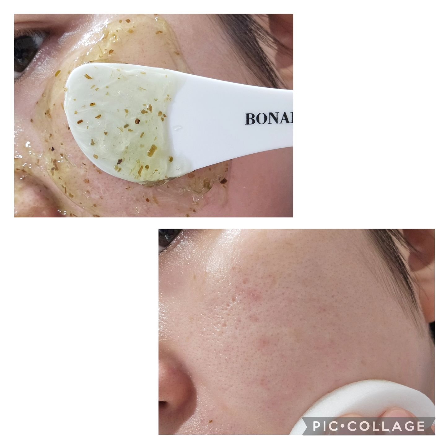 ティーツリーピュリファイングマスク/BONABELLA/洗い流すパック・マスクを使ったクチコミ（3枚目）