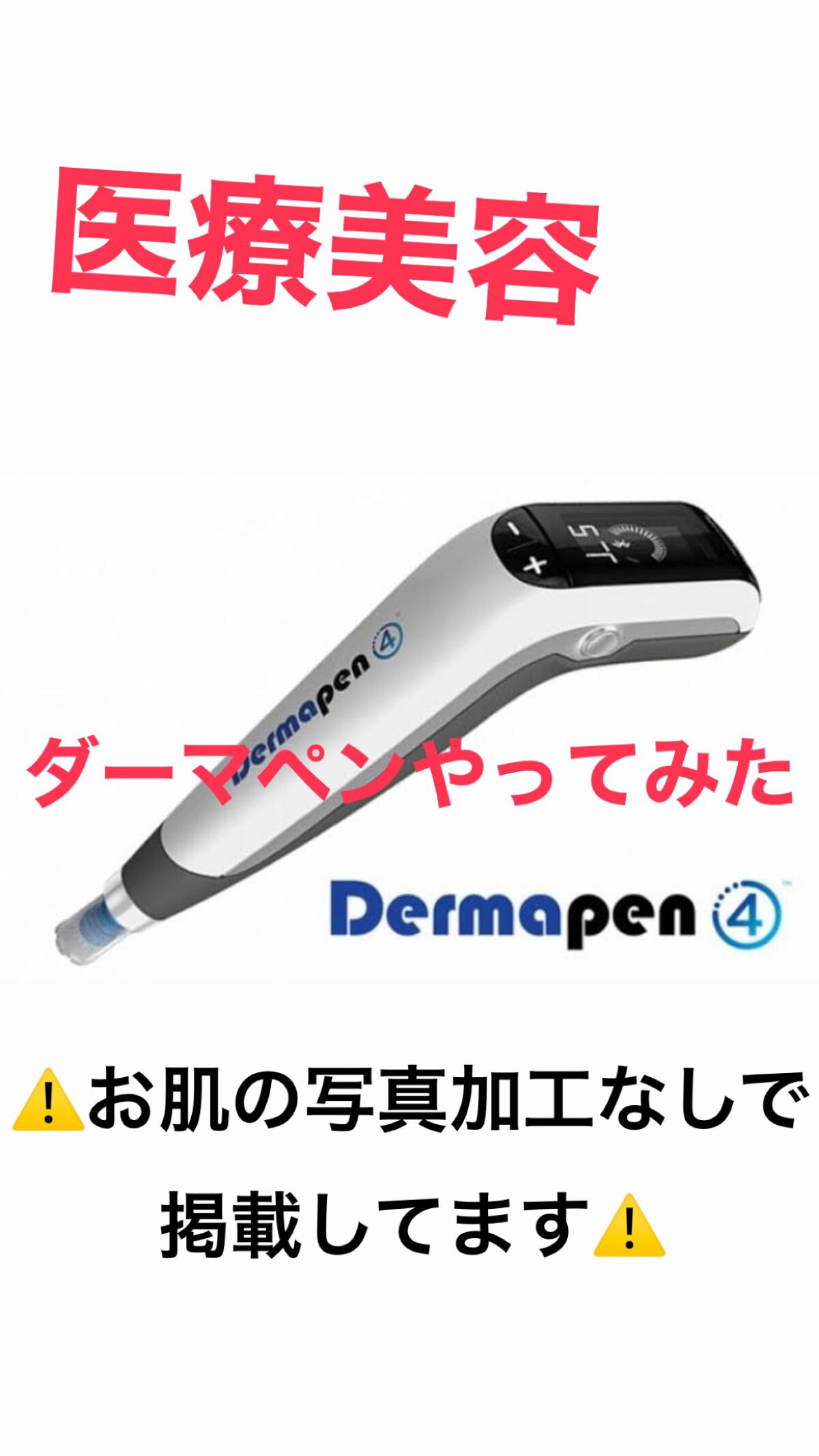 ダーマペン4

毛穴やクレーターなどに効く美容医療です。
私は毛穴の黒ずみを抹殺したく、施術しています。クレーターの方が効果はわかりやすいみたいです。

1日目は結構ヒリヒリしました。ヴェルヴェットスキンはあまり痛くなかったですが、ダーマペ