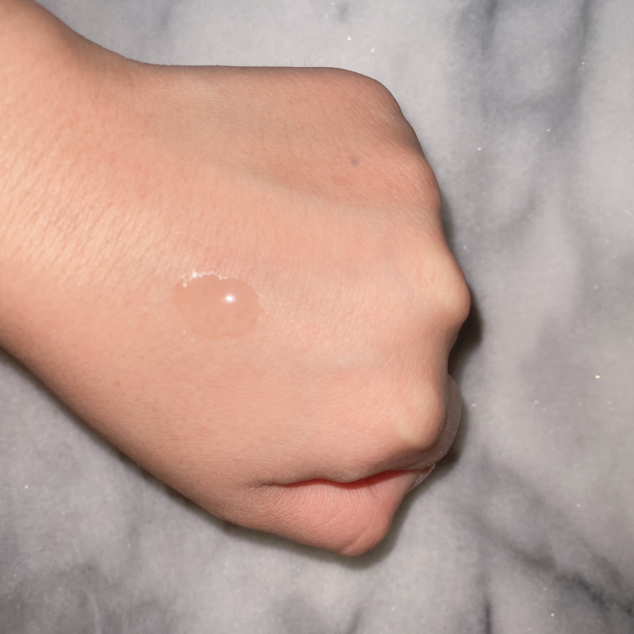 オードムーゲ 薬用ローション（ふきとり化粧水）/オードムーゲ/拭き取り化粧水を使ったクチコミ（3枚目）