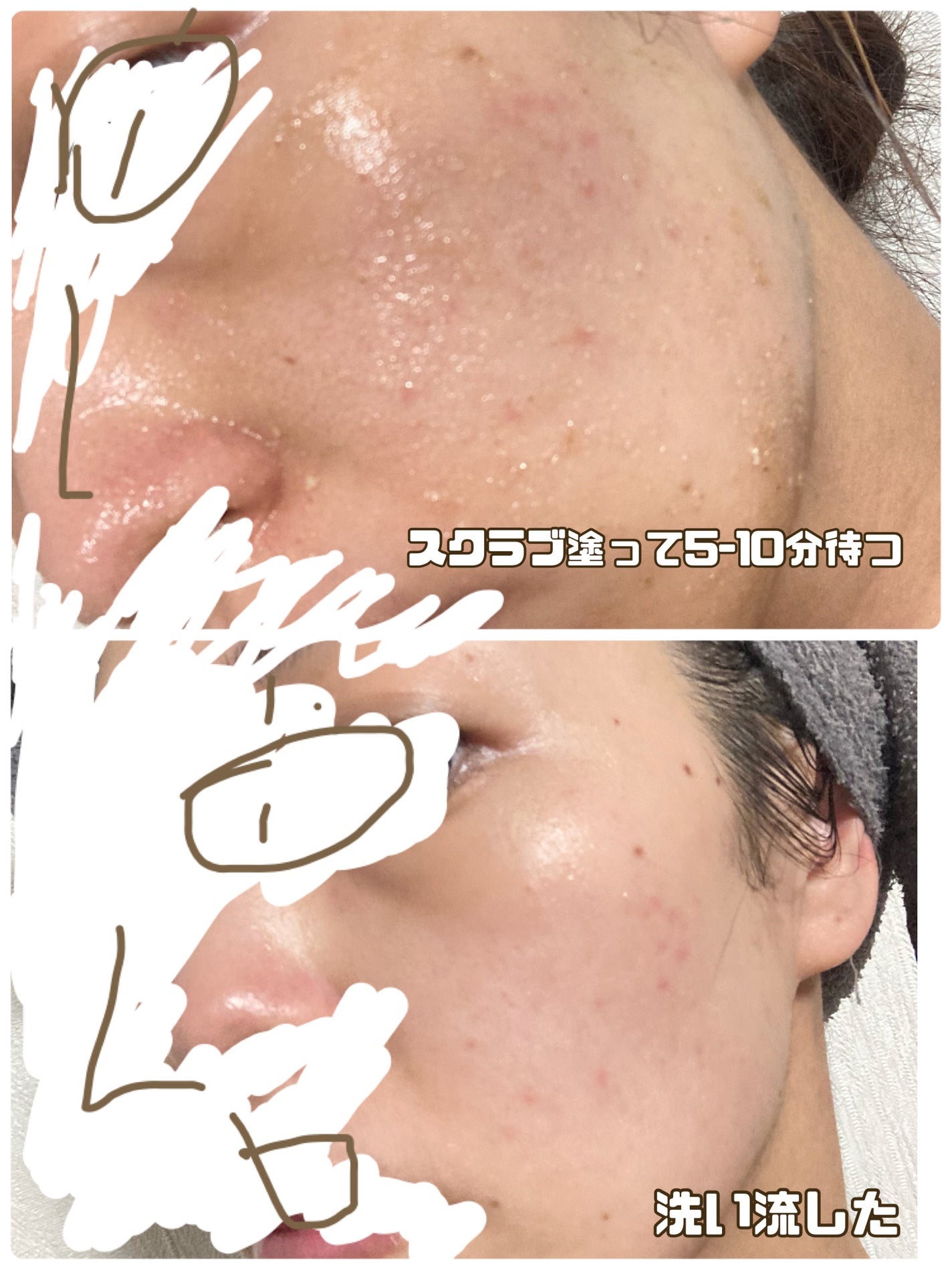 フィグスクラブマスク/I'm from/スクラブ・ゴマージュを使ったクチコミ(3枚目)