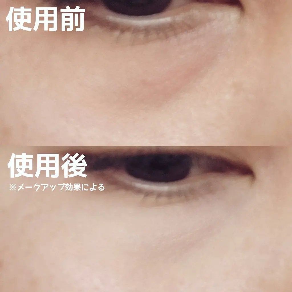 フーミー キニシーラー/WHOMEE/パレットコンシーラーを使ったクチコミ(3枚目)