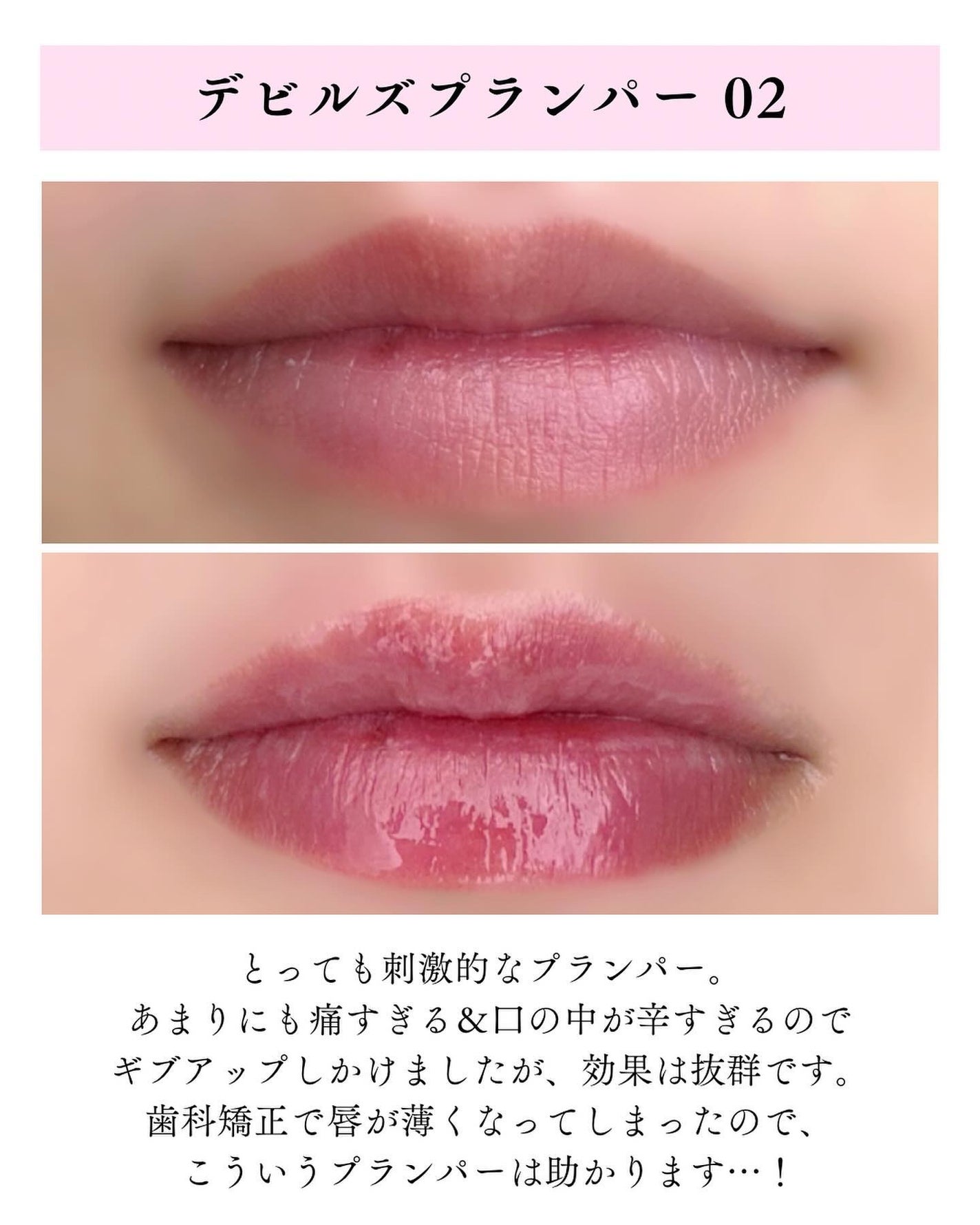 デビルズプランパー/HOLIKA HOLIKA/リッププランパーを使ったクチコミ(8枚目)