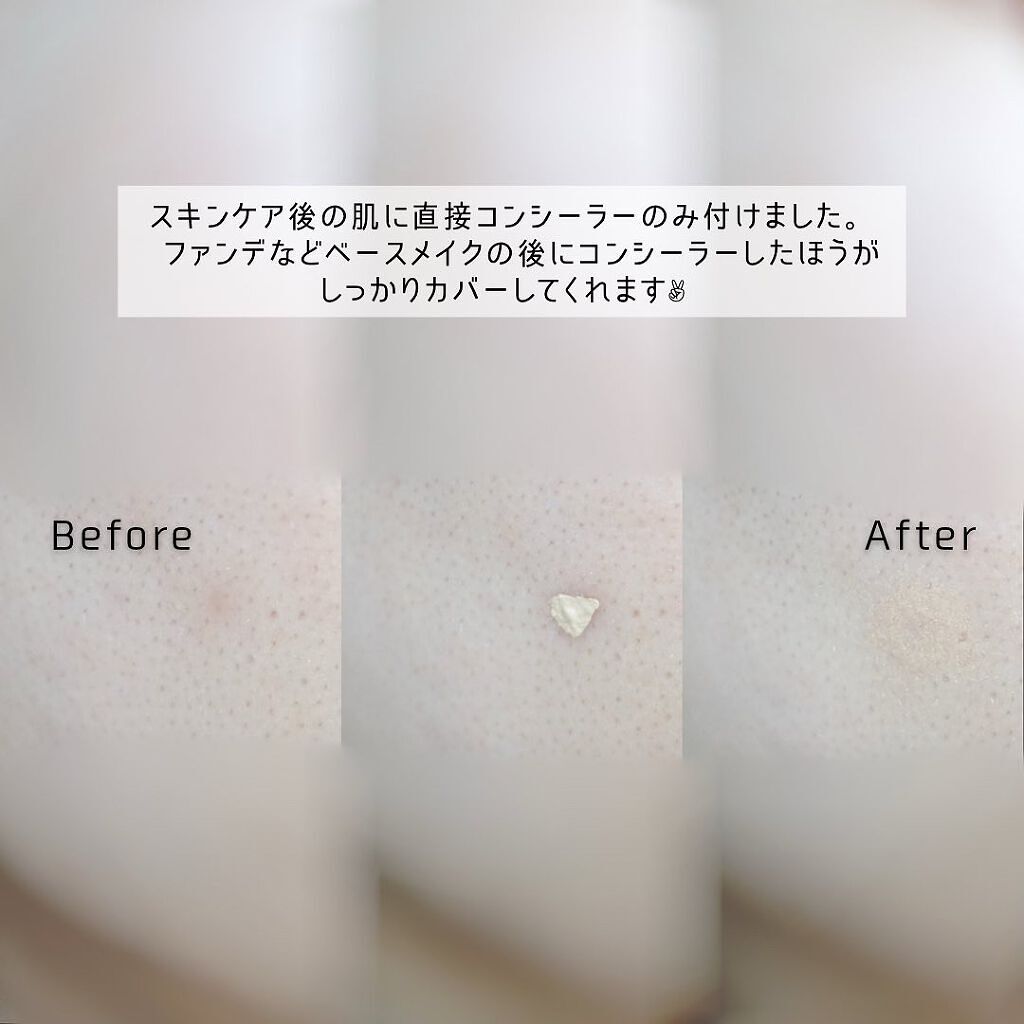 モイストラボ エッセンス薬用美白コンシーラー ナチュラルオークル03/Moist Labo/リキッドコンシーラーを使ったクチコミ（3枚目）