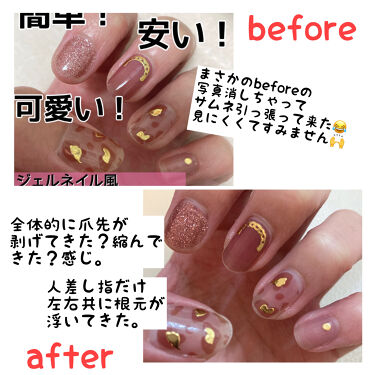 ネイルシール Qoo10の口コミ Qoo10ネイルシール Qoo10で買っ By なー 混合肌 代後半 Lips