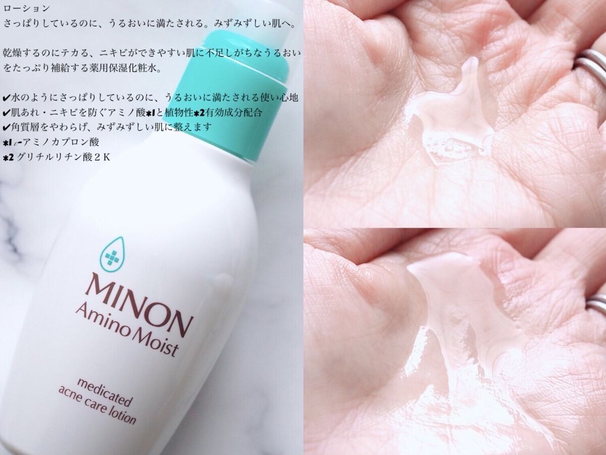 ミノン アミノモイスト 薬用アクネケア ローション/ミノン/化粧水を使ったクチコミ（3枚目）