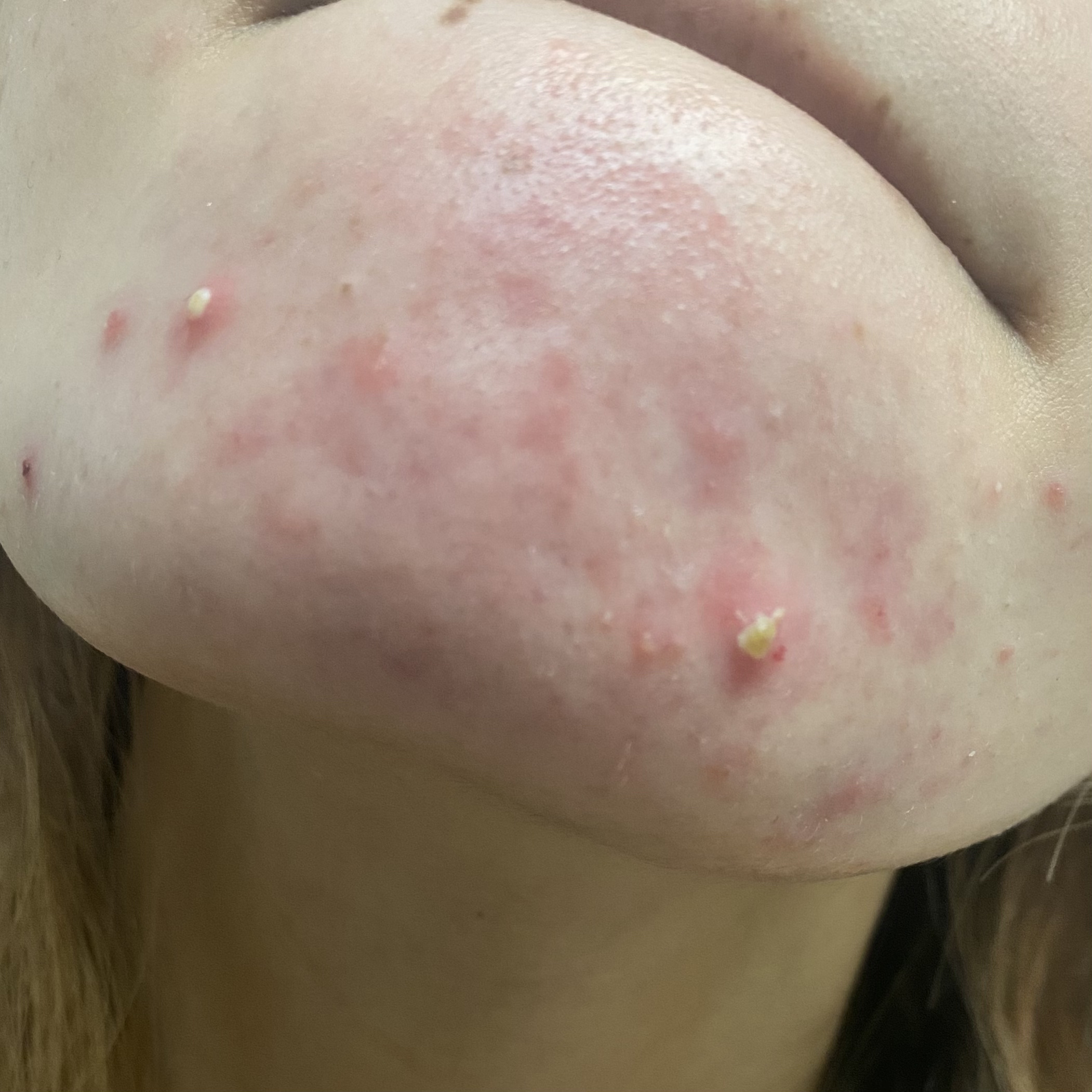 ガラクナイアシン2.0エッセンス/manyo/美容液を使ったクチコミ（2枚目）