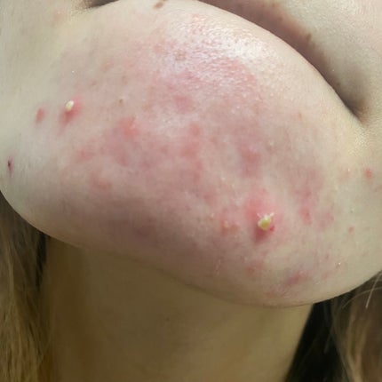 ガラクナイアシン2.0エッセンス/manyo/美容液を使ったクチコミ(2枚目)