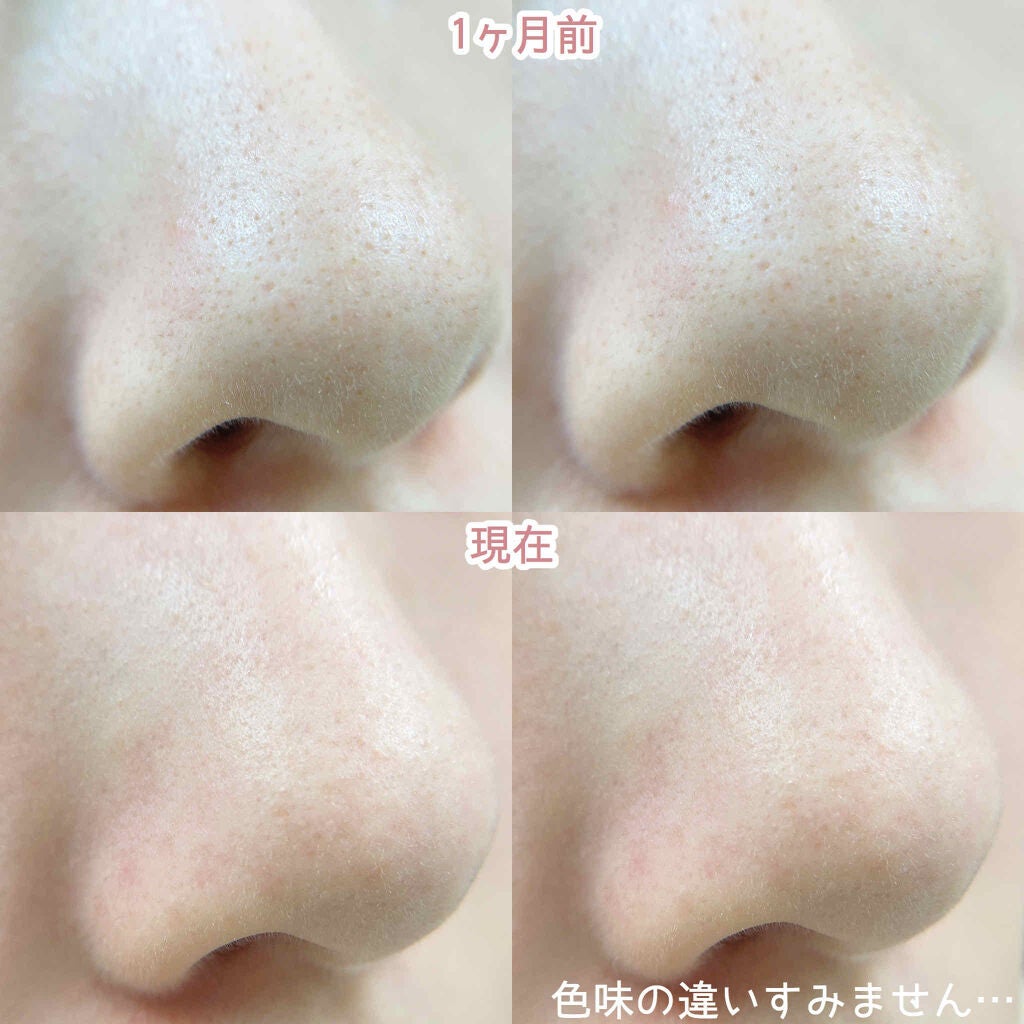 アクアフューチャースキン/アクアフューチャースキン/美顔器・マッサージを使ったクチコミ(2枚目)