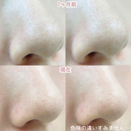 アクアフューチャースキン/アクアフューチャースキン/美顔器・マッサージを使ったクチコミ(2枚目)