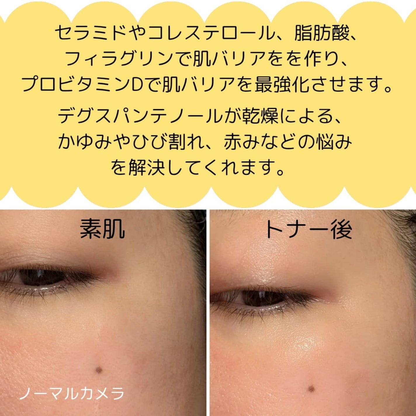 rico on LIPS 「0歳の赤ちゃんから使える優しい化粧水❢ビタミンDで最強肌バリア..」(4枚目)