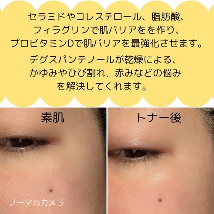 rico on LIPS 「0歳の赤ちゃんから使える優しい化粧水❢ビタミンDで最強肌バリア..」(4枚目)