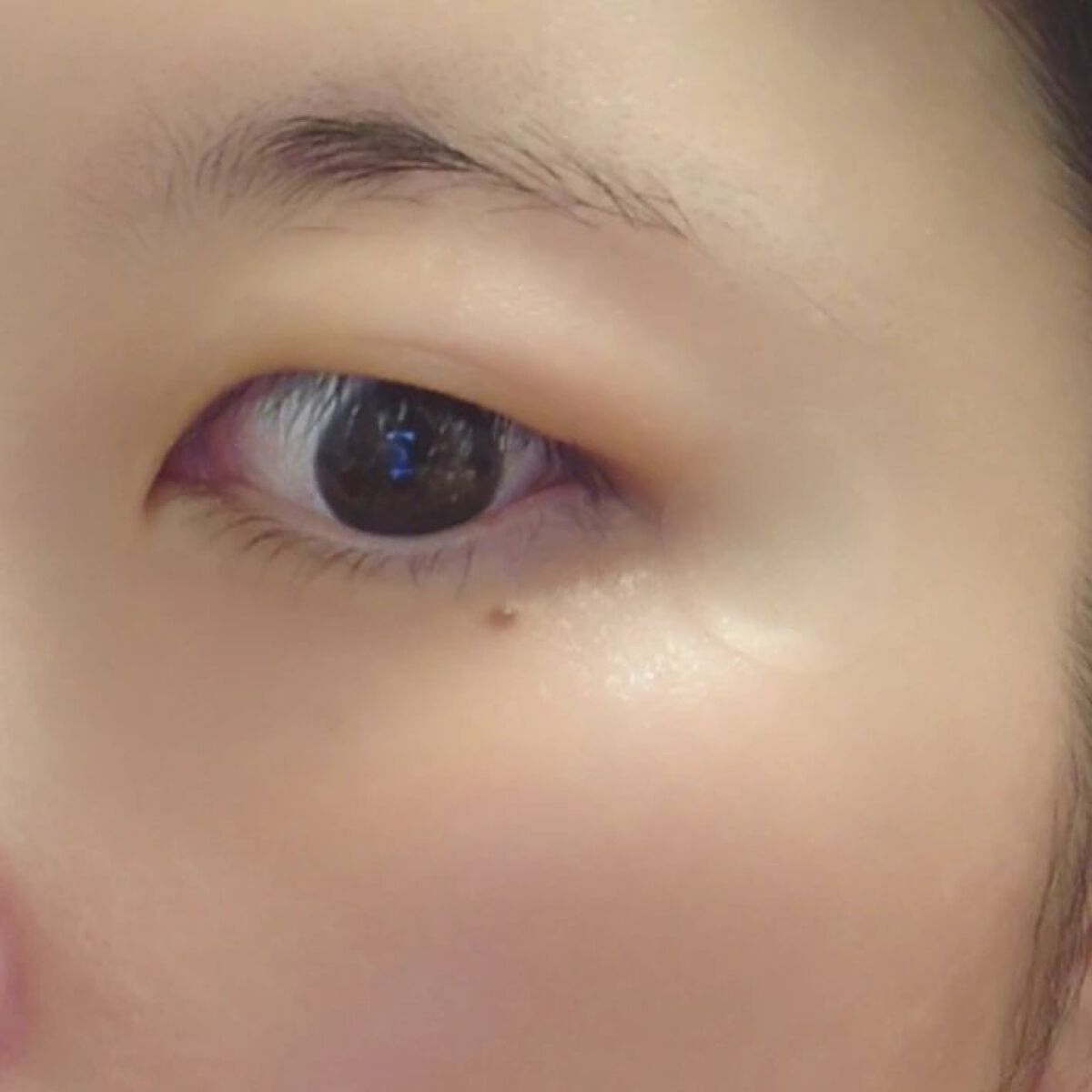 マイクロニードル ポイントパッチ/Lassovie/その他スキンケアを使ったクチコミ（3枚目）