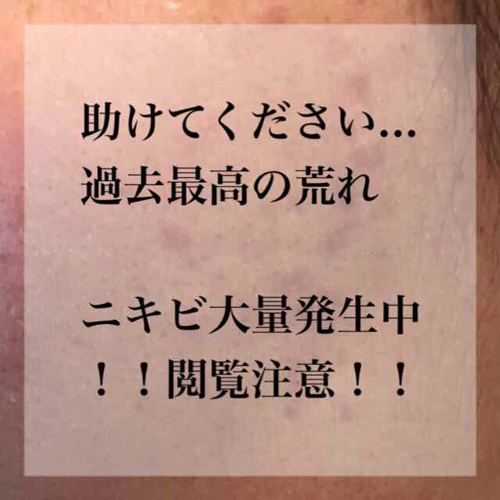 薬用保湿化粧水/オードムーゲ/化粧水を使ったクチコミ(1枚目)