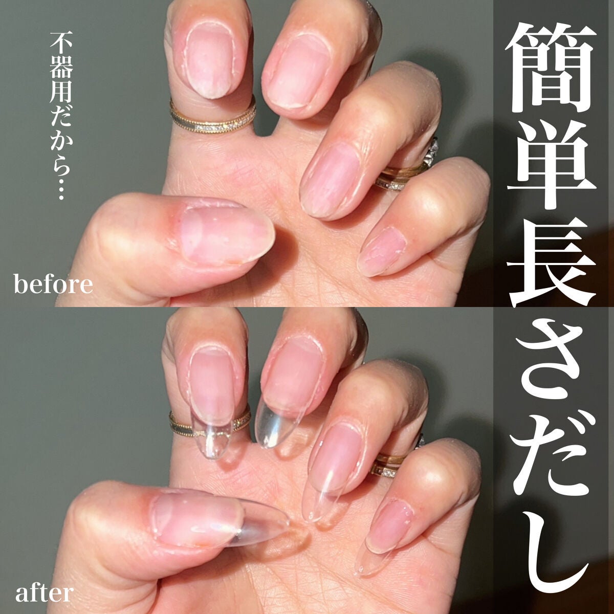 フレキシブルチップ/グレースジェル/ネイル用品を使ったクチコミ(1枚目)