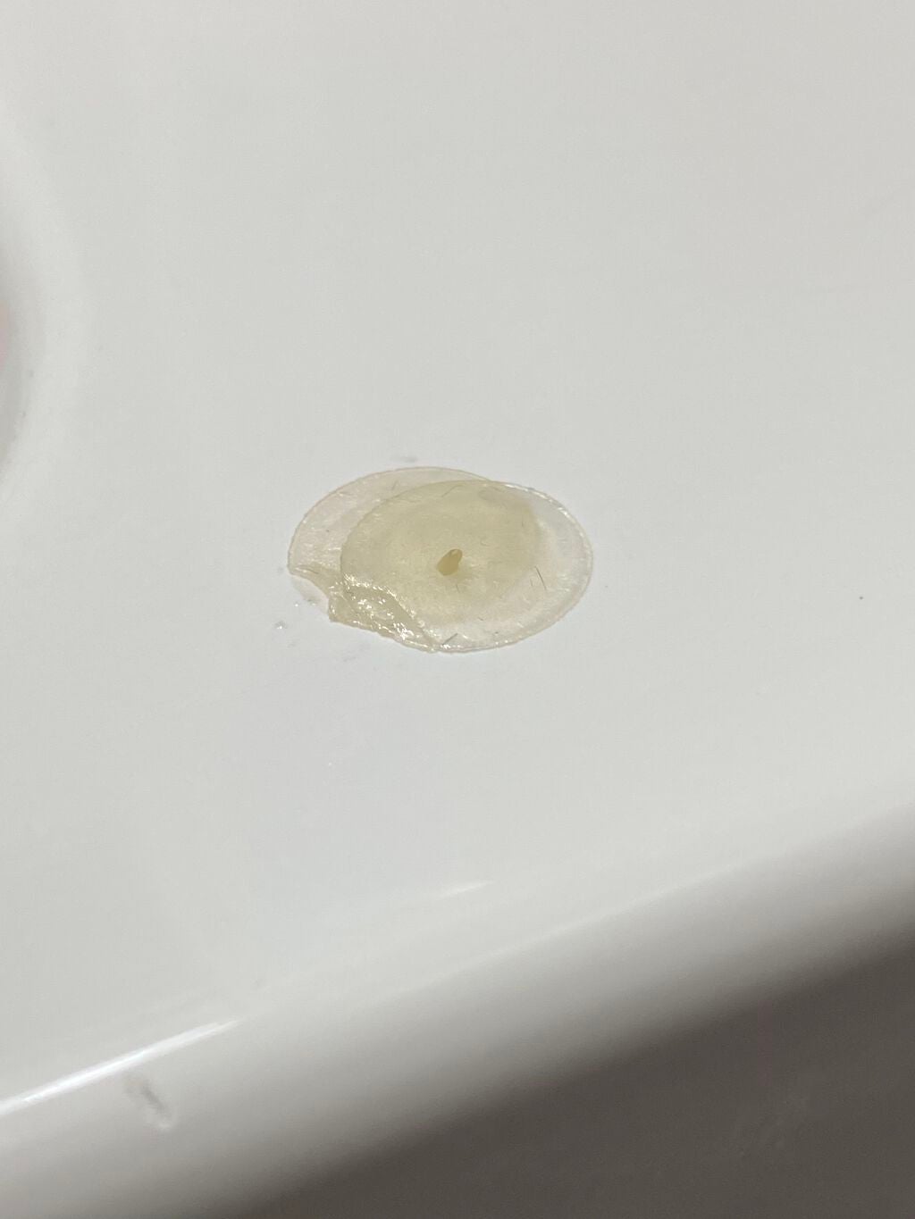 rsl on LIPS 「助けてください(><)どう言ったケアすればいいんですか?宜しく..」(2枚目)