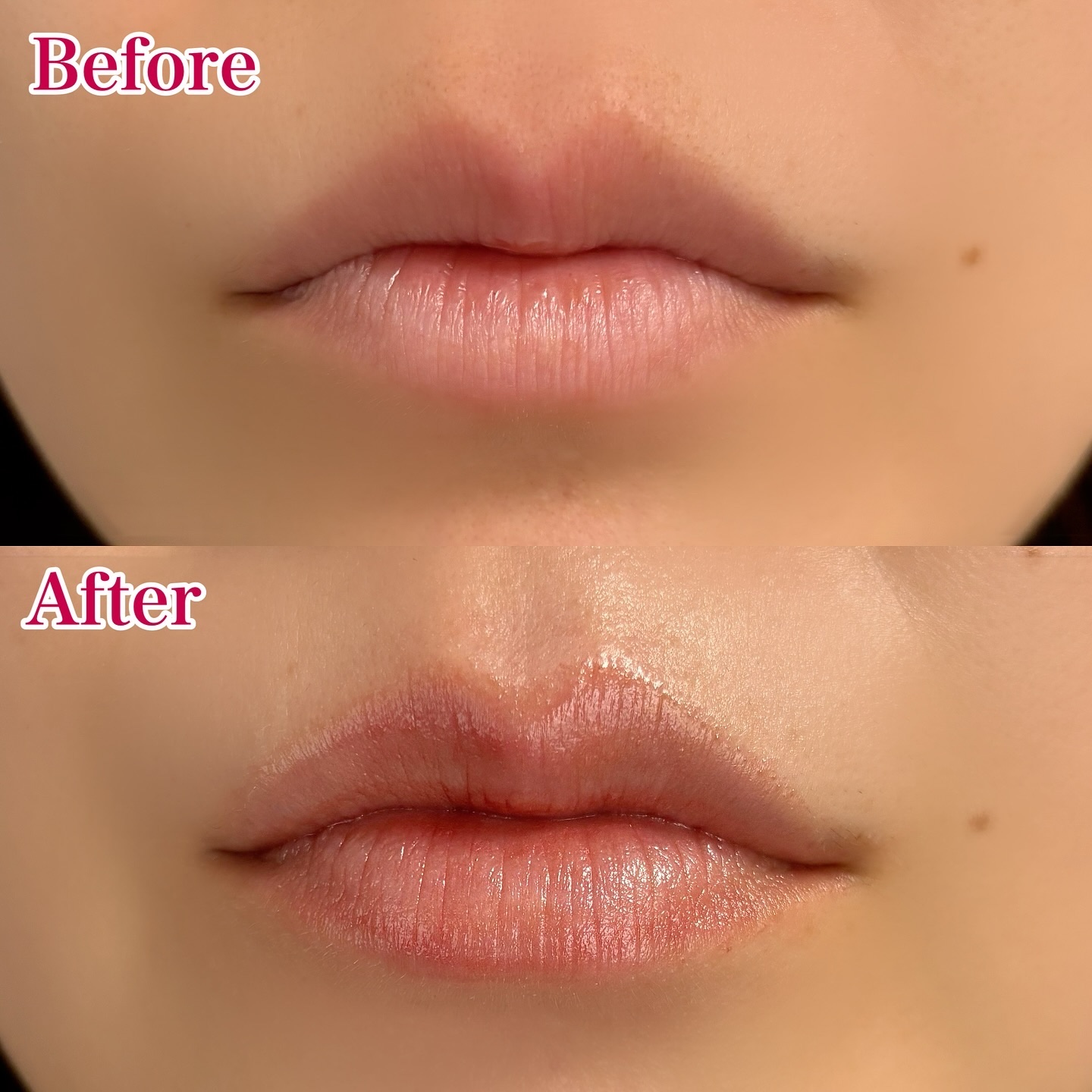 リップケア クリーム（美発色シリーズ）/キュレル/リップクリームを使ったクチコミ（3枚目）